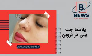 پلاسما جت بینی در قزوین | بهترین دکتر پلاسماجت بینی در تهران و قزوین